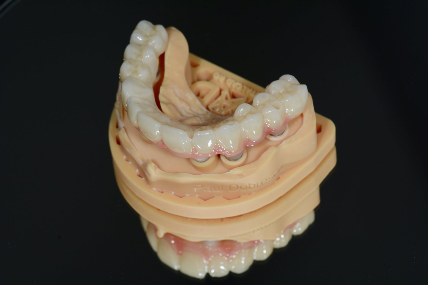 Lucrare definitivă din zirconia pe implanturi, pe model printat
