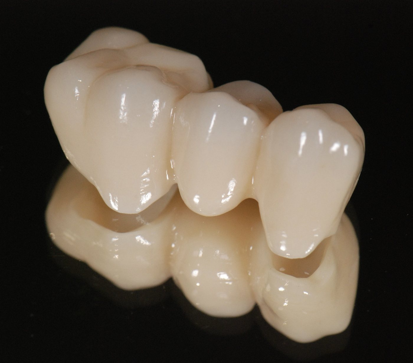 Punte dentară din zirconia pentru dinții frontali