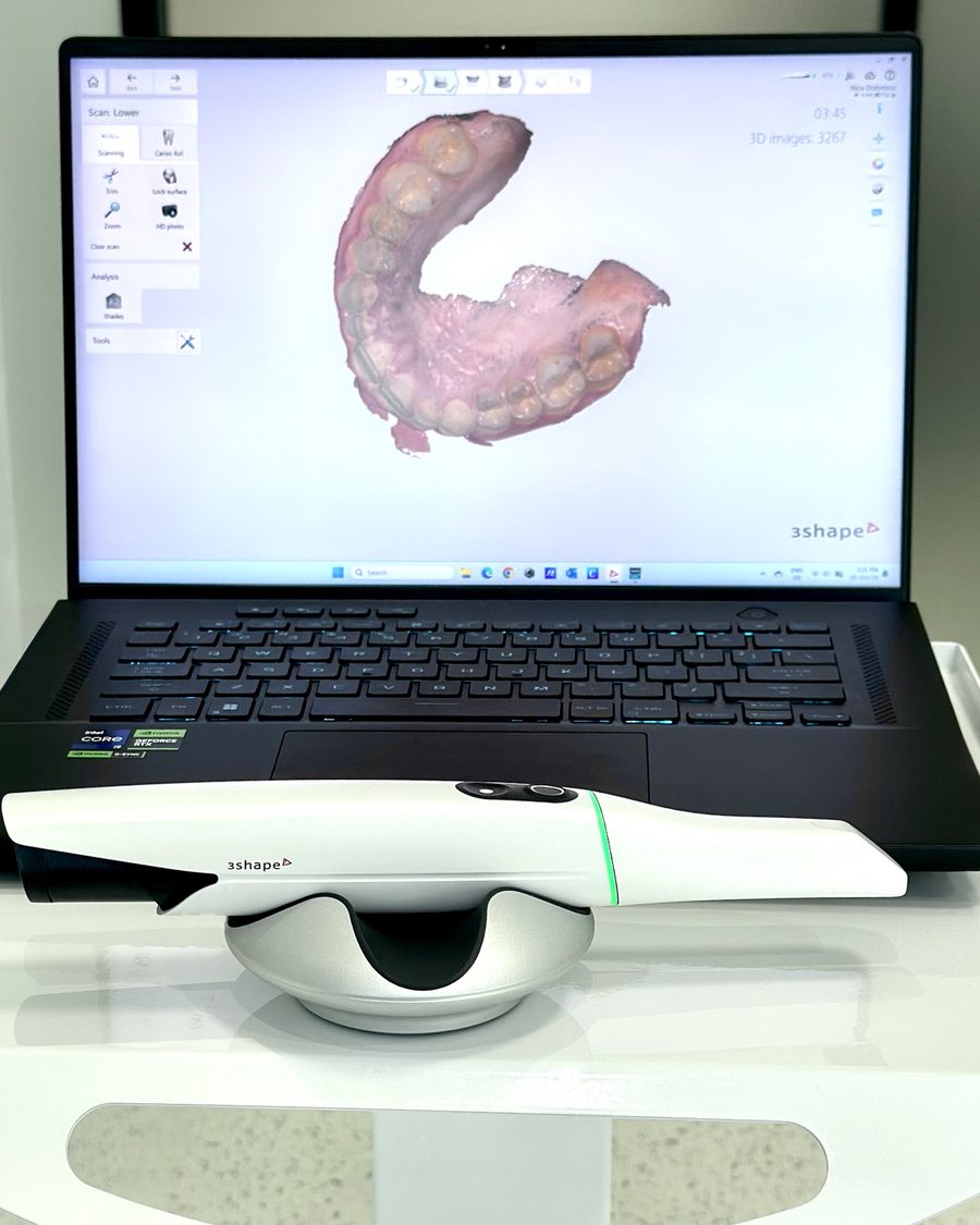 Scannerul intraoral 3Shape TRIOS 5 lângă ecranul cu modelul 3D al arcadei